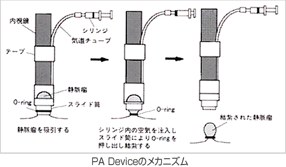 PA Deviceのメカニズム