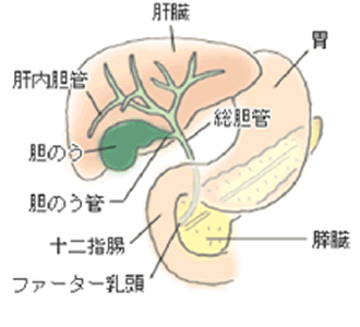 原因 胆嚢 ポリープ